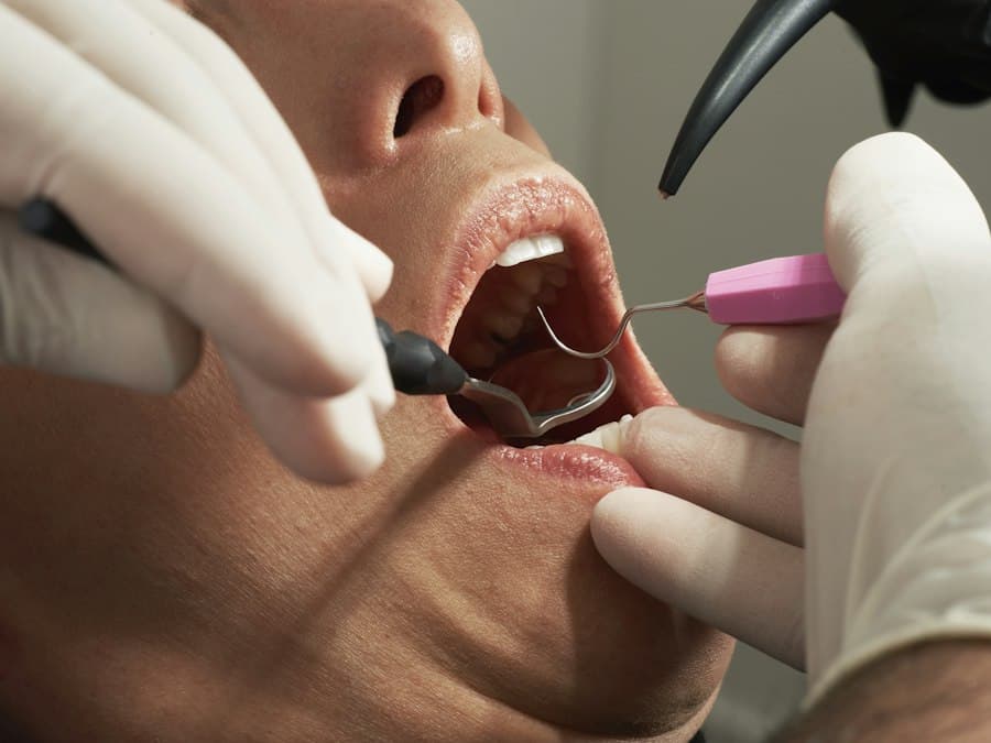 Dental exam